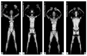 Getting Your Private Parts X-Rayed at the Airport